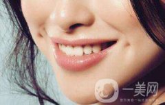 酒窩整形價(jià)格是多少 酒窩手術(shù)風(fēng)險(xiǎn)大嗎