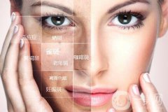 像素激光好嗎?有沒有危害嗎?術(shù)后如何護(hù)理?