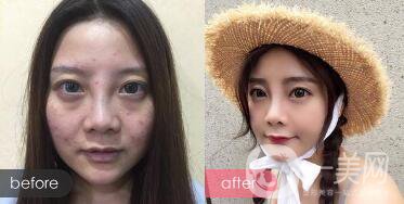 光電美容項目
