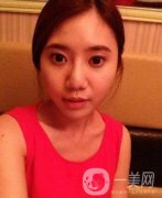 去頰脂墊果圖賞析 沒有就沒有傷害