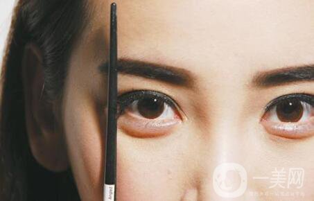 秀眉一般要多少錢(qián)