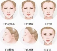 玻尿酸豐下巴打一支好還是兩支好？