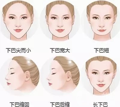 玻尿酸豐下巴