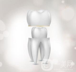 烤瓷牙的種類(lèi)和優(yōu)缺點(diǎn)分別是什么呢？