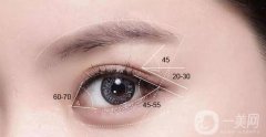 阿爾法美眼術(shù)過(guò)程是怎么做的?