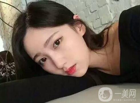 雙下巴吸脂后一個(gè)月還是有雙下巴，是失敗了嗎?