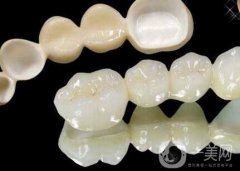 二氧化鋯全瓷牙修復(fù)果怎么樣？