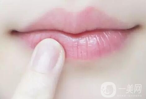 嘴角上揚整形