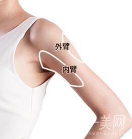 上臂吸脂多久恢復(fù)？需要住院嗎？