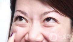 去眼袋手術價格是多少？與哪些因素有關？