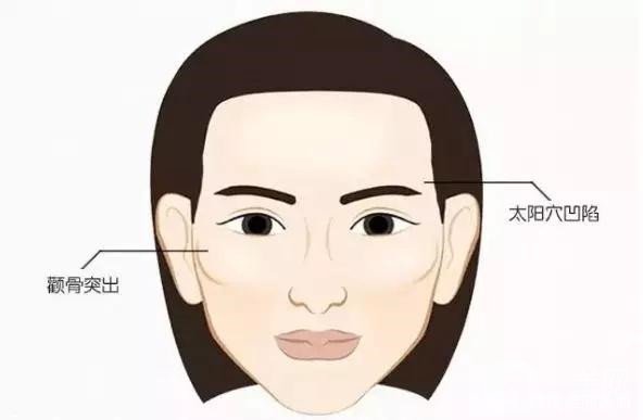 顴骨內(nèi)推和磨骨之間的區(qū)別是什么？哪個(gè)*果好些？
