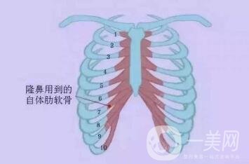 肋軟骨隆鼻為什么老受推薦？到底好在哪里？