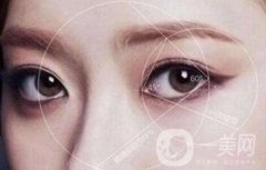 開眼角要多少錢？單獨開眼角價格貴不貴？