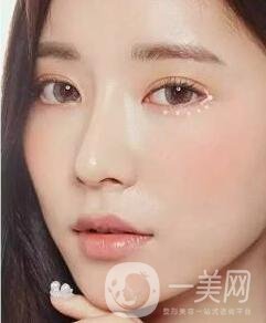 開眼角前后照片圖，放大眼睛不是一點點