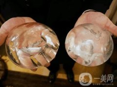 曼托假體和麥格假體哪種手感更好？教你怎么選擇？