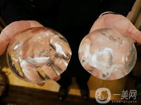 曼托假體和麥格假體哪種手感更好？教你怎么選擇？