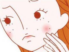 激光祛斑祛痘好不好？要調(diào)節(jié)多少次？