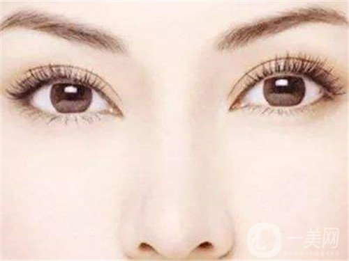 假體隆鼻多久完全消腫？怎么加速消腫呢？