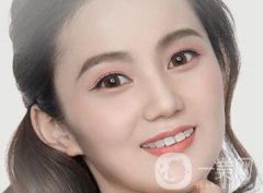 歪鼻矯正注意事項(xiàng)說明?包括術(shù)前術(shù)后哦