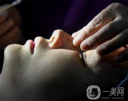 硅膠隆鼻能保持多久？可以終身保持嗎？