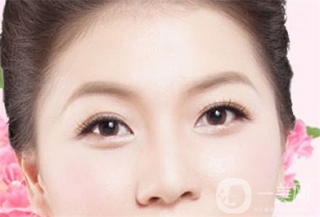 韓式開眼角多少錢？普遍價位是多少？