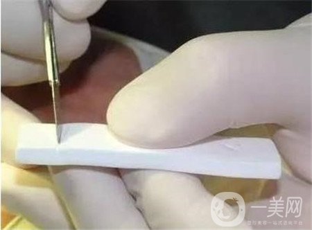 膨體隆鼻術(shù)后注意事項有哪些？需要忌口嗎？