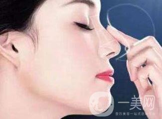 鼻子整形價格多少錢？影響價格因素有哪些？