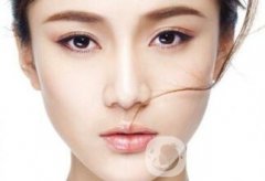假體隆鼻果怎么樣呢？是否自然？