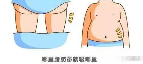 自體脂肪填充術前檢查及術后護理事項