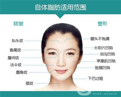 北京自體脂肪填充醫(yī)院有哪些？好的有哪些？