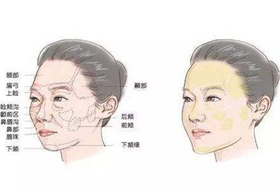 北京自體脂肪填充醫(yī)院有哪些？好的有哪些？
