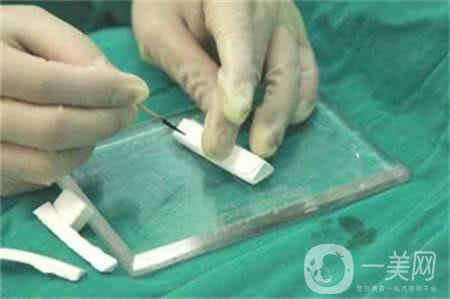 假體隆鼻術(shù)價(jià)格大概是多少？求告知