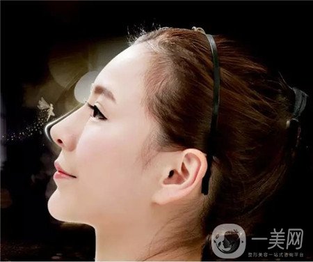 假體隆鼻術(shù)價(jià)格大概是多少？求告知