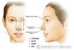 鼻小柱延長恢復(fù)過程及護理要點總結(jié)