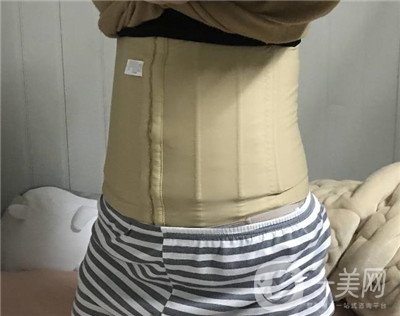 腰腹環(huán)吸后要腫多長(zhǎng)時(shí)間呢？可以活動(dòng)嗎？