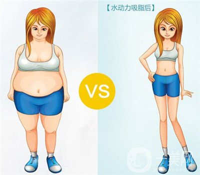 腰腹吸脂有積液怎么辦？不排出對身體有影響嗎？