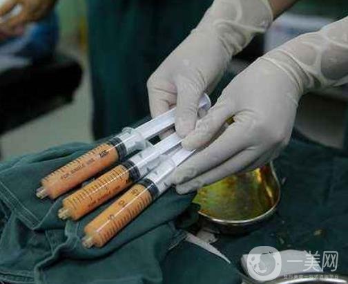 腰部吸脂的費用大概多少錢？術后真的能瘦嗎？