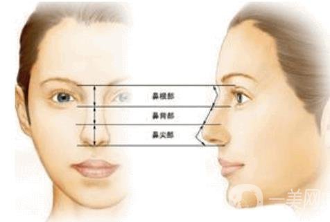 北京朝天鼻整容多少錢?具體怎么改良？