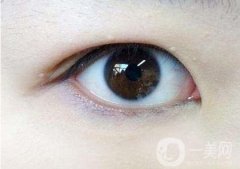 內(nèi)雙怎么變外雙？能貼雙眼皮貼嗎？