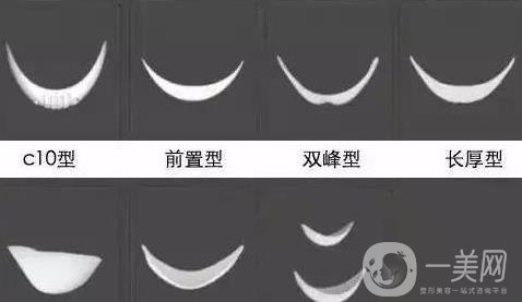 膨體隆下巴多久會變軟？容易取出來嗎？