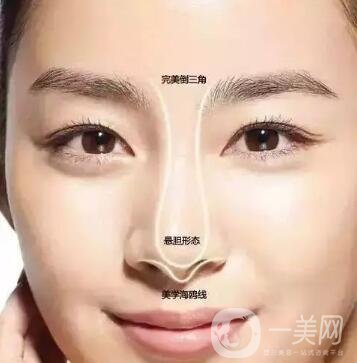 隆鼻手術(shù)怎么做？操作過程解析