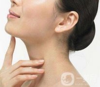 減下巴方法有哪些？可以吸脂嗎？