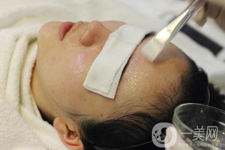 光子嫩膚價(jià)格多少？貴嗎？