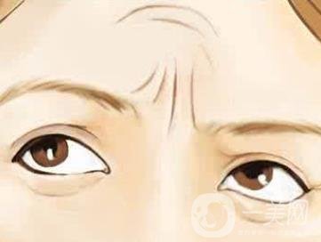 抬頭紋怎么去除？價格是多少呢？