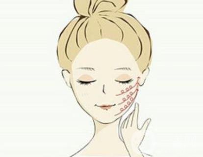 下頜角手術(shù)術(shù)后護(hù)理要注意哪些？