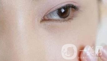 玻尿酸豐淚溝有危險嗎？能管多久？