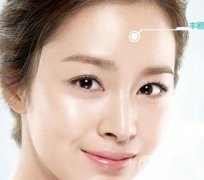 隆額頭材料哪種比較好？要多少錢？