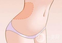 腹壁整形多少錢？費(fèi)用詳細(xì)解說