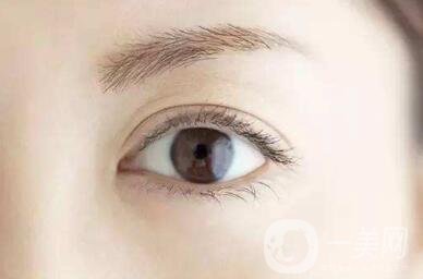 開(kāi)眼角好嗎？*果怎么樣？