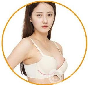 娜綺麗假體隆胸后多久可以變軟？